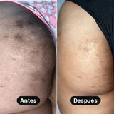 Crema Blank para zonas oscuras – Axilas, entrepierna, entre glúteos, rodillas, codos y cuello
