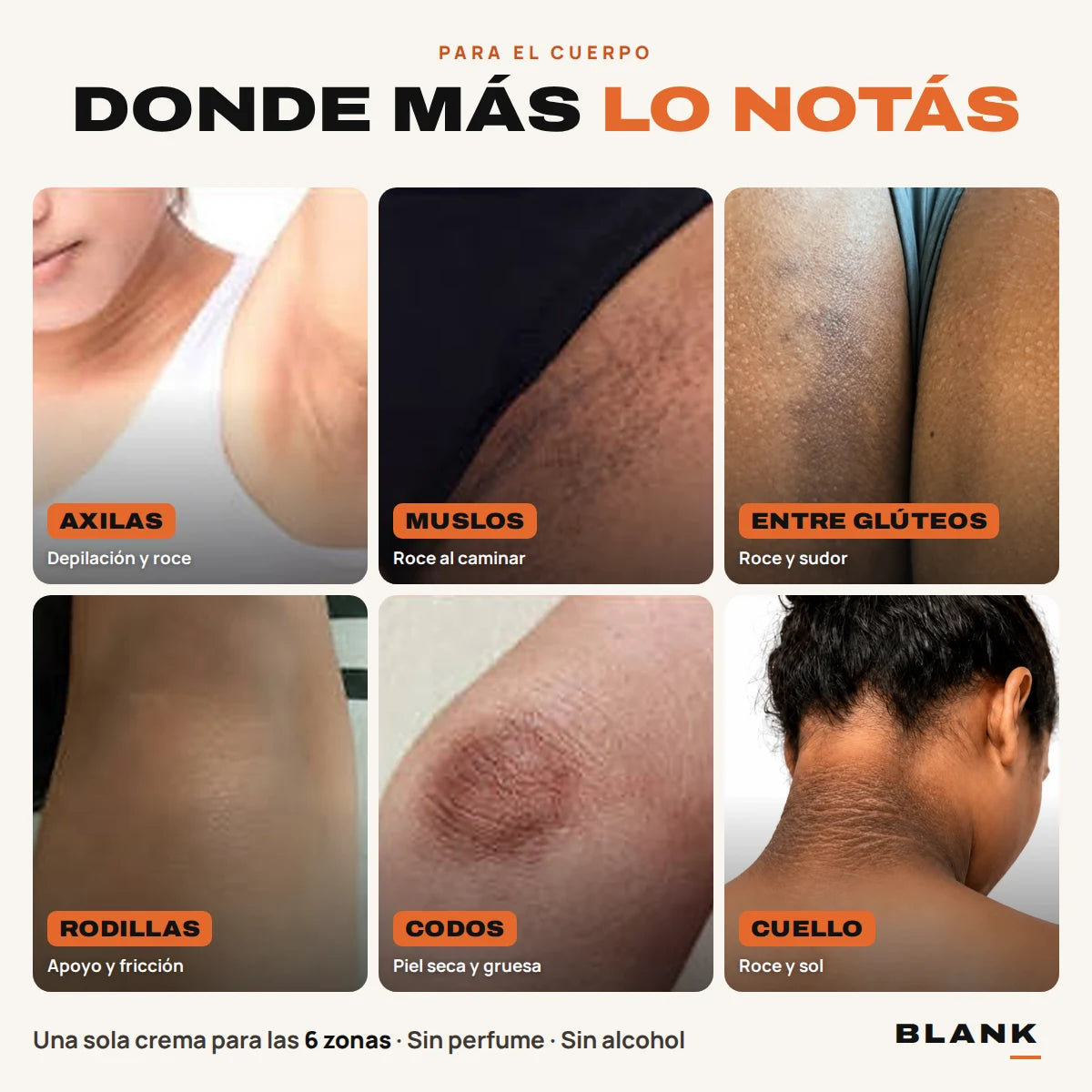Crema Blank para zonas oscuras – Axilas, entrepierna, entre glúteos, rodillas, codos y cuello