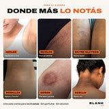 Crema Blank para zonas oscuras – Axilas, entrepierna, entre glúteos, rodillas, codos y cuello